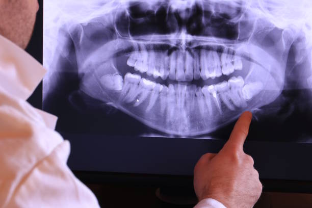 Best Tooth Infection Emergency Dentist  in Owasso, OK